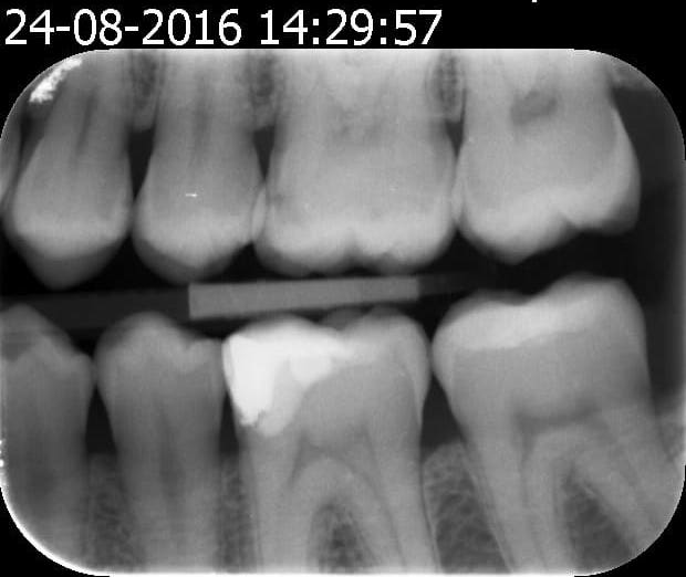 Image v2 2016 08 24 142957